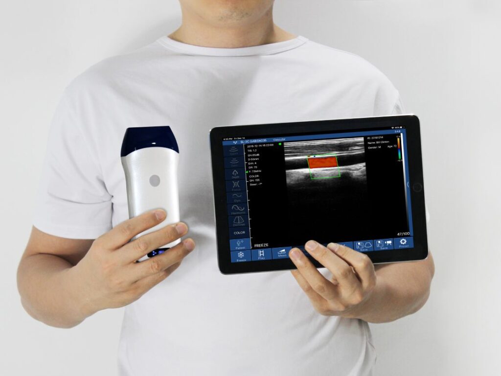 L25-BP ultrasound machine